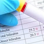 Bilirubin ne anlama geliyor? Bilirubin’in yüksekliği ve spontan kürtajı ne anlama geliyor ve kürtaj?