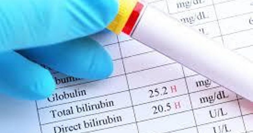 Bilirubin ne anlama geliyor? Bilirubin’in yüksekliği ve spontan kürtajı ne anlama geliyor ve kürtaj?