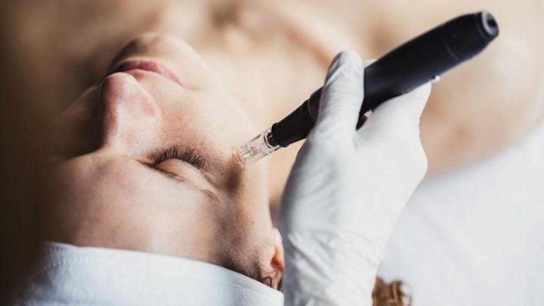 Dermapen nedir, ne yapar? Dermatpen tedavisi nasıl uygulanır?