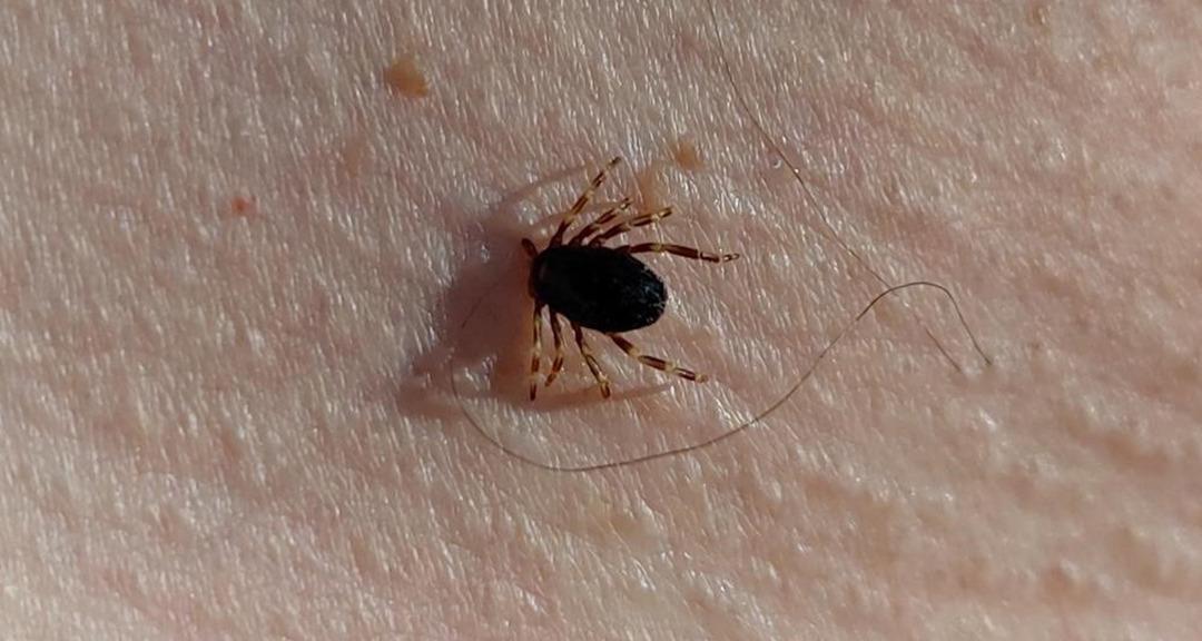 Keneler Tehlike: Lyme hastalığa neden olur: bu semptomlara dikkat! Uzmanlar uyarıyor: 
