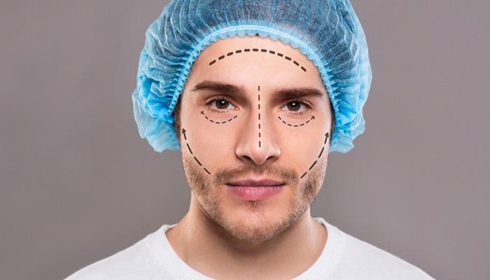 Hızla artan estetik: erkeklerde yüz uzatma eğilimi! Uzmanlar risklerle uyardı: “Endişeleniyor”