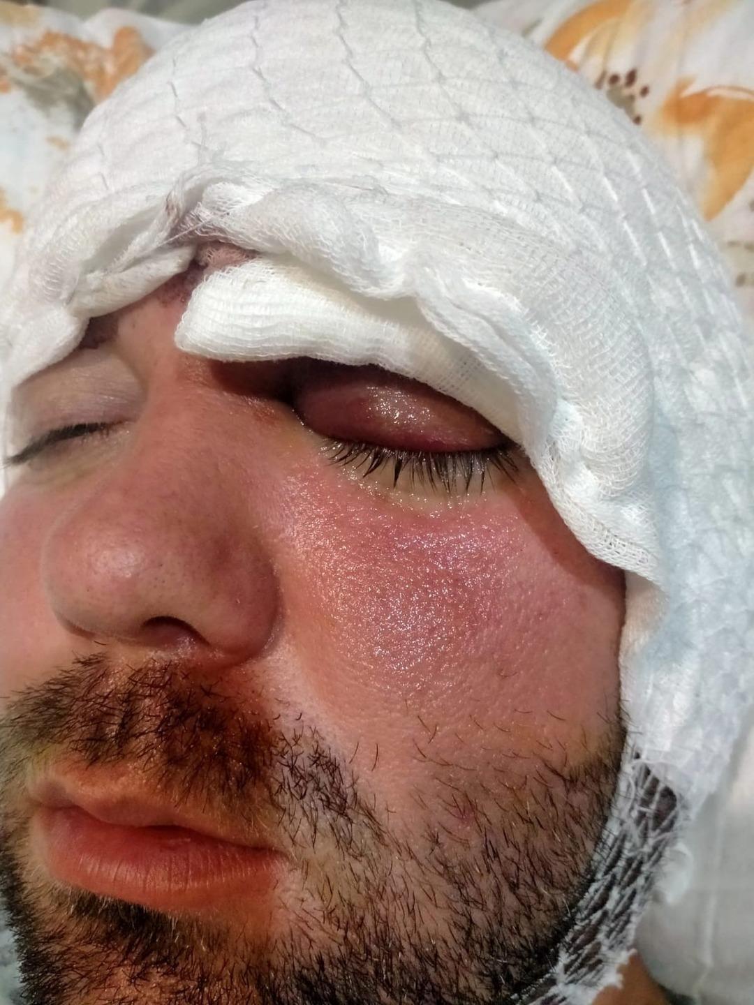 Bursa'da inanılmaz olay: Dişçiye gitti, hayatı kabusa döndü! Neredeyse ölüyordu 5