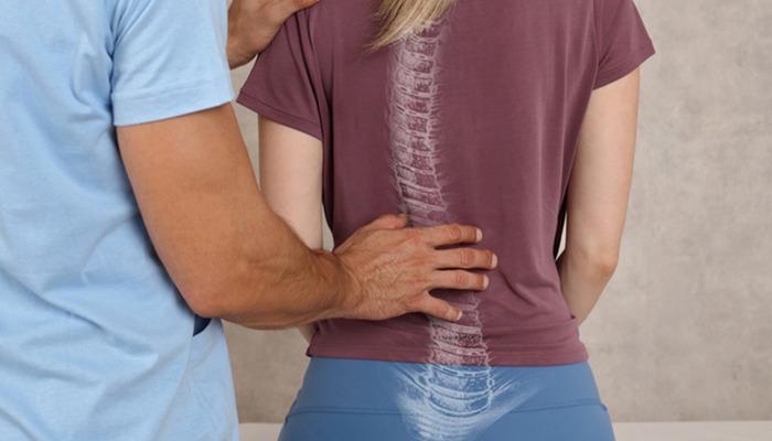 Skolyozda cerrahi olmayan tedavi yöntemi: “Schroth Terapisi” nedir?