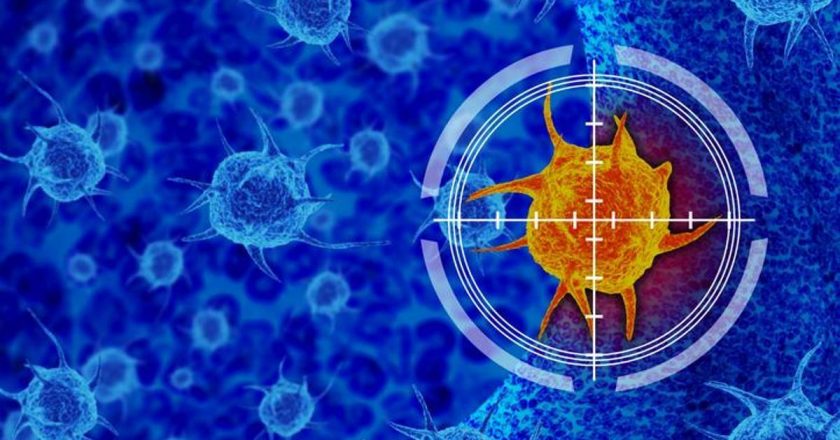 Prostat kanserinin belirtileri nelerdir? Prostat kanseri nasıl anlanır? Prostat tedavi yöntemleri nelerdir?