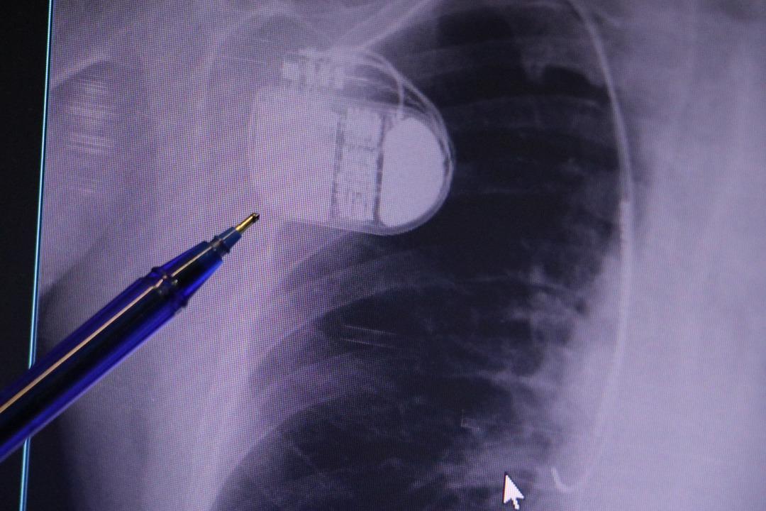 Kalp pili taşıyanlar dikkat! Soğuk hava uyarısı: