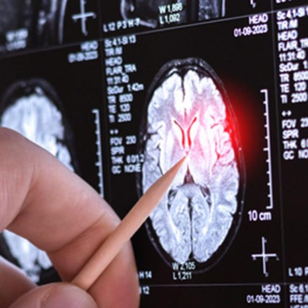 Sadece 13 kişide görüldü! Sağlık haberleri