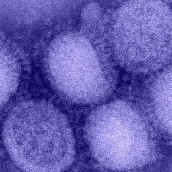 Kuzey Yarımküre’de “H3N2” alarmı! “Eşi görülmemiş grip vakaları yaşanıyor”